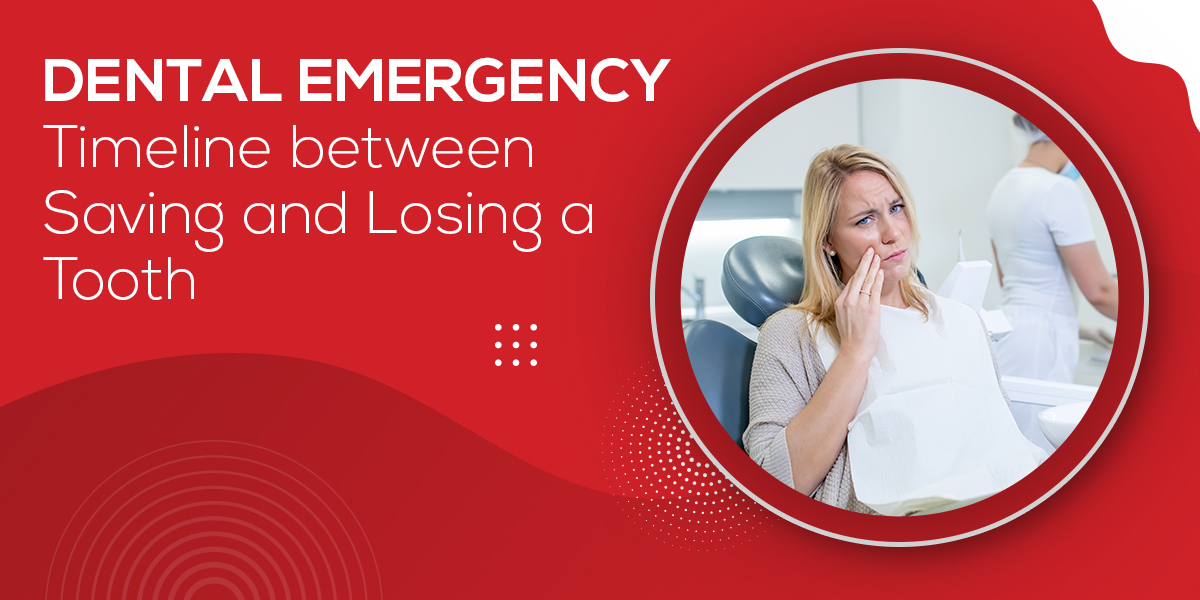 Dental Emergency: Timeline between Saving and Losing a Tooth